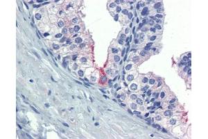 AMH antibody was used for immunohistochemistry at a concentration of 4-8 ug/ml. (AMH antibody  (Middle Region))