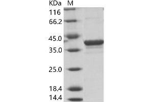 Western Blotting (WB) image for Ebola Virus Matrix protein VP40 (EBOV VP40) protein (His tag) (ABIN7198913) (EBOV VP40 Protein (His tag))