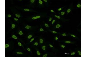Immunofluorescence of monoclonal antibody to FUBP1 on HeLa cell. (FUBP1 antibody  (AA 27-136))