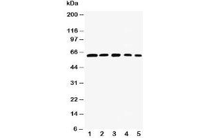 Western blot testing of RelB antibody and Lane 1:  rat testis;  2: (h) HeLa;  3: (m) NIH3T3;  4: (h) Raji;  5: (m) HEPA cell lysate. (RELB antibody  (AA 393-413))
