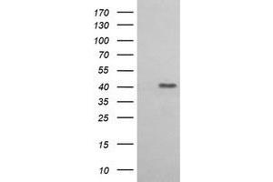 Western Blotting (WB) image for anti-Acetyl-CoA Acyltransferase 2 (ACAA2) antibody (ABIN1495726)