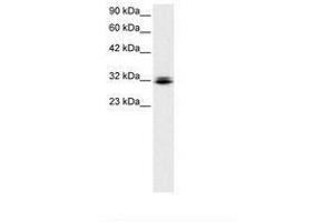 Image no. 1 for anti-Retina and Anterior Neural Fold Homeobox (RAX) (N-Term) antibody (ABIN6735790) (RAX antibody  (N-Term))