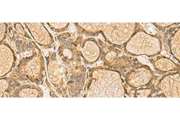 HORMAD2 antibody