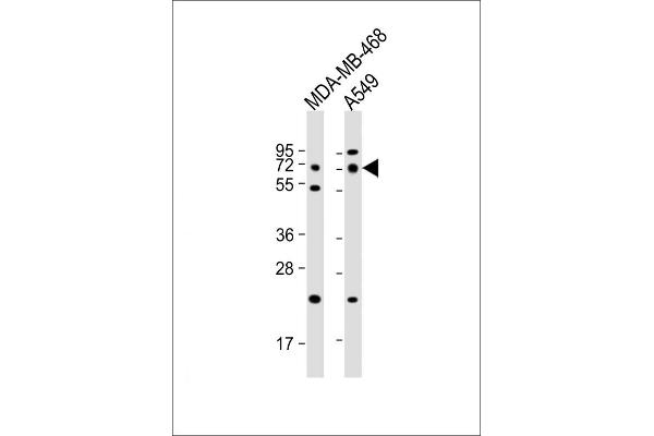 PRODH anticorps  (AA 130-155)
