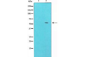 Western blot analysis of GSK3 alpha phosphorylation expression in ovary cancer whole cell lysates,The lane on the left is treated with the antigen-specific peptide. (GSK3 alpha antibody  (pSer21))