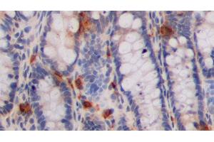 Detection of 5-HT in Rat Colon Tissue using Polyclonal Antibody to 5-Hydroxytryptamine (5-HT) (Serotonin antibody)