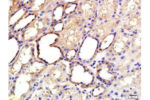 Formalin-fixed and paraffin embedded human kidney labeled with Anti ANGPTL3/ANG5 Polyclonal Antibody, Unconjugated  at 1:200 followed by conjugation to the secondary antibody and DAB staining (ANGPTL3 antibody  (AA 21-120))