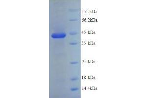 SDS-PAGE (SDS) image for Plasminogen Activator Inhibitor 1 (SERPINE1) (AA 23-402) protein (His tag) (ABIN5713826)