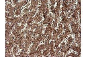Image no. 2 for anti-serine/threonine Kinase 38 Like (STK38L) (AA 1-281) antibody (ABIN1490699) (STK38L antibody  (AA 1-281))