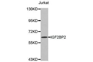 Western blot analysis of extracts of Jurkat cell line, using IGF2BP2 antibody. (IGF2BP2 antibody  (C-Term))