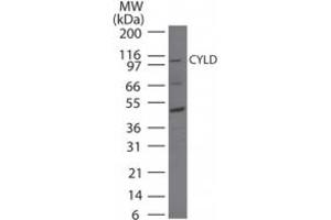 Image no. 1 for anti-Cylindromatosis (Turban Tumor Syndrome) (CYLD) (AA 32-45) antibody (ABIN200017) (CYLD antibody  (AA 32-45))