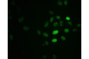Immunofluorescence staining of Hela cells with ABIN7127742 at 1:100,counter-stained with DAPI. (Recombinant RPA2 antibody  (pThr21))