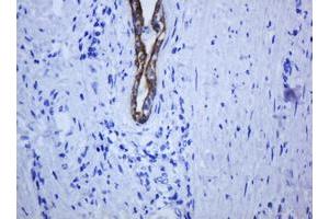 Image no. 7 for anti-Keratin 5 (KRT5) (AA 1-273) antibody (ABIN1490696)
