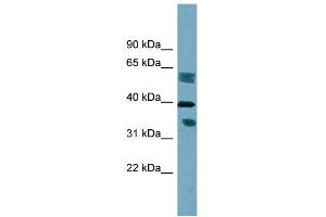 WB Suggested Anti-DHRS7B Antibody Titration:  0. (DHRS7B antibody  (Middle Region))