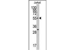 Western blot analysis of TERF1 polyclonal antibody  in Jurkat cell line lysates (35 ug/lane).