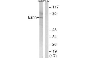 Western blot analysis of extracts from K562 cells, using Ezrin (epitope around residue 478) antibody.