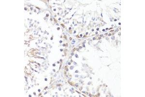 Immunohistochemistry of paraffin-embedded mouse testis using P-MYC-T58 antibody (ABIN3019538, ABIN3019539, ABIN3019540 and ABIN6225454) at dilution of 1:100 (40x lens). (c-MYC antibody  (pThr58))