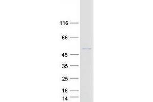 Validation with Western Blot (POC1A Protein (Myc-DYKDDDDK Tag))