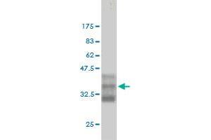 Western Blot detection against Immunogen (35. (CDK13 antibody  (AA 1-90))