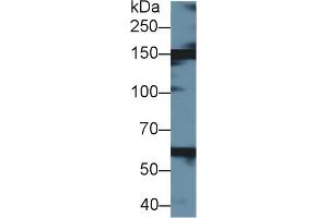 Detection of XDH in Bovine Liver lysate using Polyclonal Antibody to Xanthine Dehydrogenase (XDH) (XDH antibody  (AA 2-219))