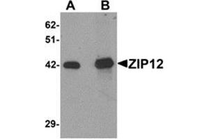 Western blot analysis of ZIP12 in HepG2 cell lysate with ZIP12 antibody at (A) 0.