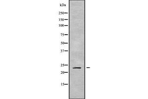Western blot analysis of CLDN9 using COLO205 whole cell lysates (Claudin 9 antibody  (C-Term))