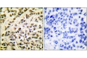 Immunohistochemistry (IHC) image for anti-Friend Leukemia Virus Integration 1 (FLI1) (AA 291-340) antibody (ABIN1533277)