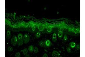 Immunohistochemistry analysis using Rabbit Anti-Rab5 Polyclonal Antibody . (RAB5 antibody  (Atto 594))