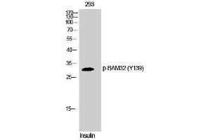 Western Blotting (WB) image for anti-Dual Adaptor of Phosphotyrosine and 3-phosphoinositides (DAPP1) (pTyr139) antibody (ABIN3179600) (DAPP1 antibody  (pTyr139))