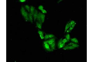 Immunofluorescent analysis of Hela cells using SGO1 antibody at a dilution of 1:100 and Alexa Fluor 488-conjugated Goat Anti-Rabbit IgG antibody. (Shugoshin antibody  (AA 260-439))