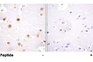 Immunohistochemical analysis of paraffin-embedded human brain tissue using JUN polyclonal antibody . (C-JUN antibody)