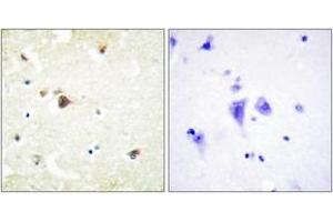 Immunohistochemistry analysis of paraffin-embedded human brain tissue, using TRIM3 Antibody. (TRIM3 antibody  (AA 1-50))