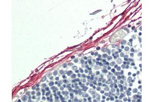Human Fibroblasts: Formalin-Fixed, Paraffin-Embedded (FFPE). (Indian Hedgehog antibody  (HRP))