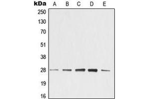 Western blot analysis of 14-3-3 zeta expression in KNRK (A), NIH3T3 (B), C4 (C), EOC20 (D), CTLL2 (E) whole cell lysates. (14-3-3 zeta antibody  (Center))