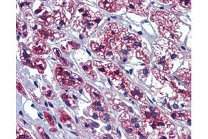 Immunohistochemistry (IHC) image for anti-GTP-Binding Protein 10 (GTPBP10) (Middle Region) antibody (ABIN2773813) (GTPBP10 antibody  (Middle Region))