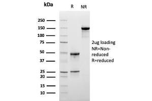 SDS-PAGE Analysis Purified Monospecific Mouse Monoclonal Antibody to LSP1 (LSP1/3025). (LSP1 antibody  (AA 174-278))