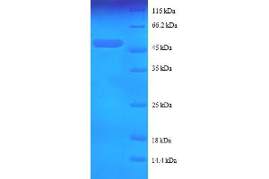 SDS-PAGE (SDS) image for Keratin 5 (KRT5) (AA 2-198) protein (GST tag) (ABIN5712810)