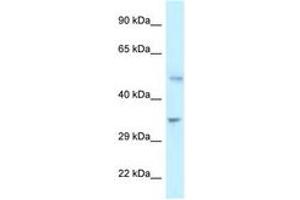 Image no. 1 for anti-6-phosphofructo-2-Kinase/fructose-2,6-Biphosphatase 1 (PFKFB1) (C-Term) antibody (ABIN6747349)