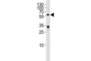 Western blot analysis of lysate from HepG2 cell line using IL1R1 antibody diluted at 1:1000. (IL1R1 antibody  (AA 474-503))