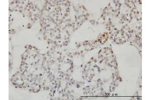 Image no. 3 for anti-Sestrin 2 (SESN2) (AA 1-481) antibody (ABIN466250) (Sestrin 2 antibody  (AA 1-481))