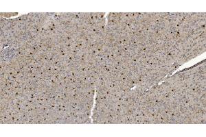 IHC analysis of Alpha B Crystallin/CRYAB using anti-Alpha B Crystallin/CRYAB antibody (ABIN7601209). (CRYAB antibody  (AA 30-151))