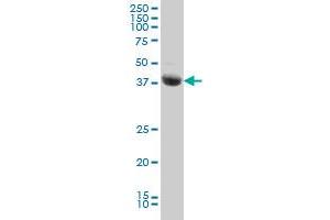 STK17B monoclonal antibody (M01), clone 2C3 Western Blot analysis of STK17B expression in Jurkat . (DRAK2 antibody  (AA 272-372))