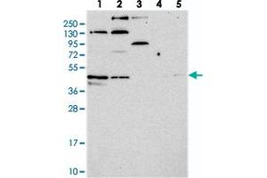 Western blot analysis of Lane 1: RT-4, Lane 2: U-251 MG, Lane 3: Human Plasma, Lane 4: Liver, Lane 5: Tonsil with C14orf80 polyclonal antibody  at 1:250-1:500 dilution.