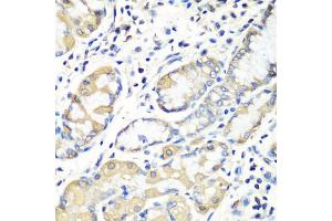 Immunohistochemistry of paraffin-embedded human stomach using EZR antibody (ABIN5974701) at dilution of 1/100 (40x lens). (Ezrin antibody)