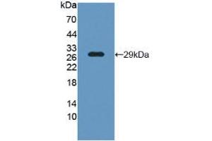 Figure. (LCP1 antibody  (AA 5-233))
