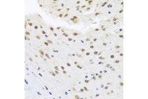 Immunohistochemistry of paraffin-embedded mouse brain using HDAC4 antibody. (HDAC4 antibody)