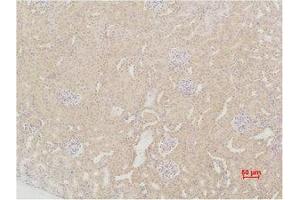 Immunohistochemistry (IHC) analysis of paraffin-embedded Mouse Kidney Tissue using SOD2 Polyclonal Antibody. (SOD2 antibody)