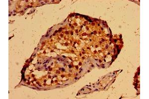 Immunohistochemistry of paraffin-embedded human testis tissue using ABIN7166440 at dilution of 1:100 (PORCN antibody  (AA 269-332))