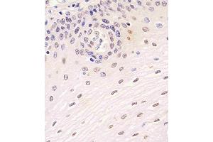A staining SIRT7 in human esophagus tissue sections by Immunohistochemistry (IHC-P - paraformaldehyde-fixed, paraffin-embedded sections). (SIRT7 antibody  (C-Term))