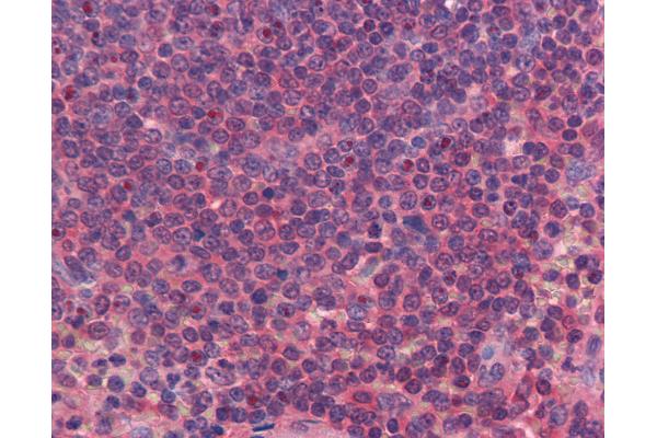 FERMT3 antibody  (C-Term)